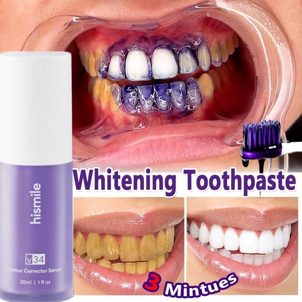 Hi-smile V34 Teeth Whitener (MADE BY USA) |Rs-1295